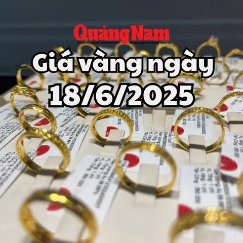 Xu Hướng Giá Vàng Ngày Mai