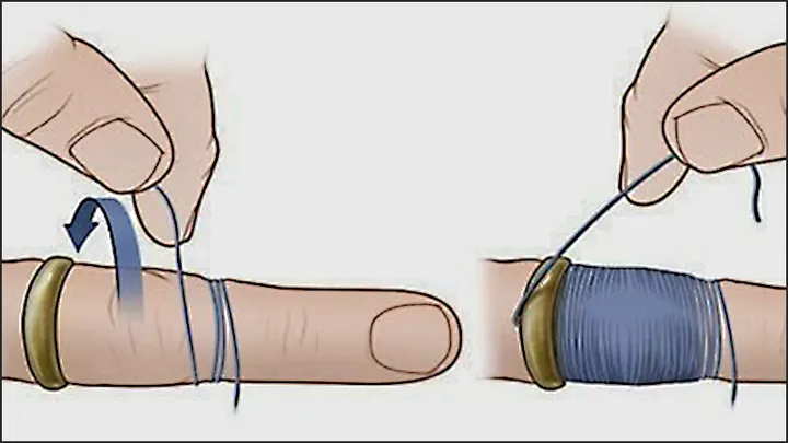 Cách Tháo Nhẫn Đeo Tay Bị Chật