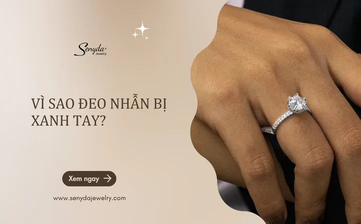 Đeo Nhẫn Vàng Bị Xanh Tay