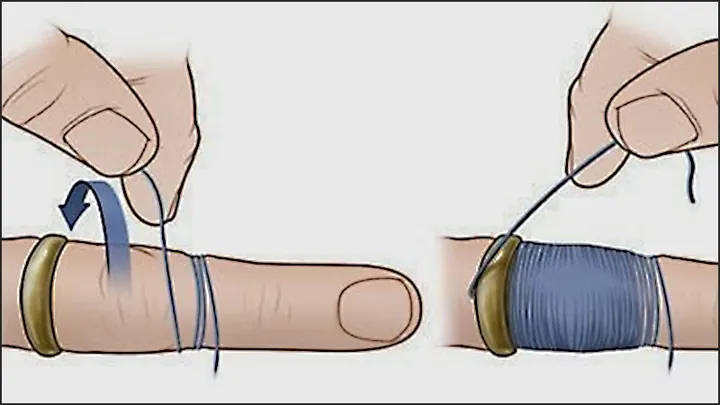 Hướng Dẫn Lấy Nhẫn Khi Quá Chặt: Cách Tháo Nhẫn Bị Chật Tại Nhà Không Đau