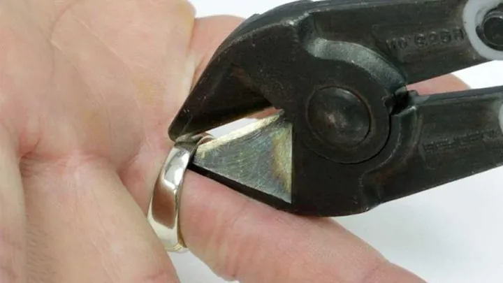 Cách Tháo Nhẫn Đeo Bị Chật Ra Khỏi Tay Nhanh Chóng, Không Đau Tại Nhà