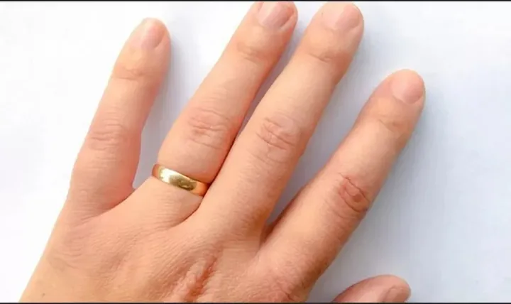 Cách Tháo Nhẫn Vàng Bị Chật Tại Nhà Nhanh Chóng, Không Đau